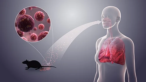 3D medical animation still showing Hantavirus.